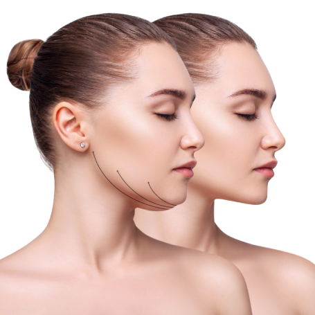 rosacea -page-cover Double Chin